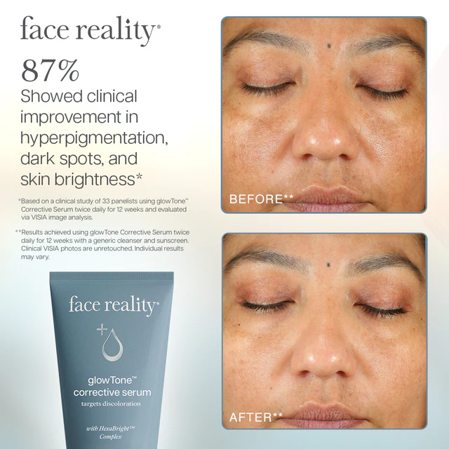 Glow Tone™ Corrective Serum