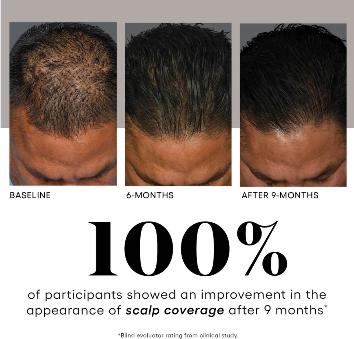 Plated Hair Serum