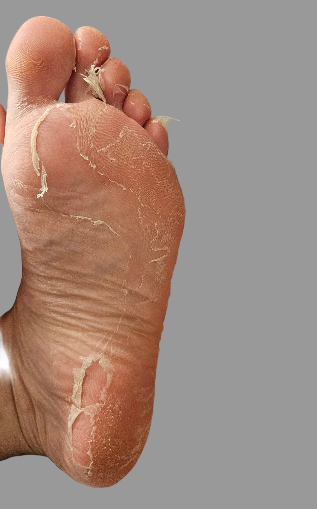 Exfoliating Foot Peel