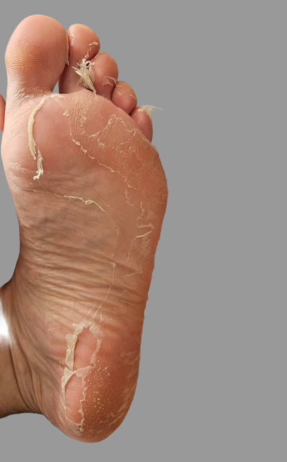 Exfoliating Foot Peel